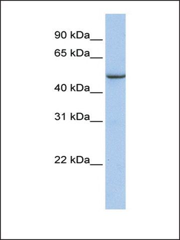 Anti-TMEM184A antibody produced in rabbit