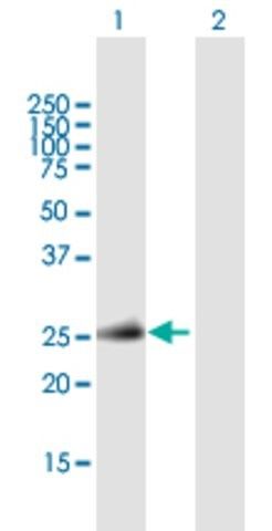 Anti-TNFSF11 antibody produced in mouse