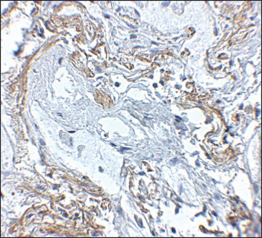 Anti-TNFAIP3 antibody produced in rabbit