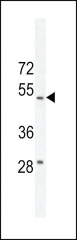 ANTI-RT4I1 (C-TERMINAL) antibody produced in rabbit