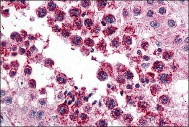 Anti-SLAIN2 antibody produced in rabbit