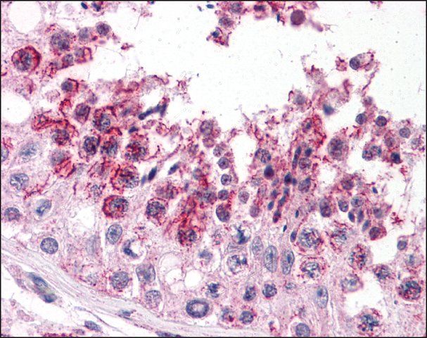 Anti-SLAIN2 antibody produced in rabbit
