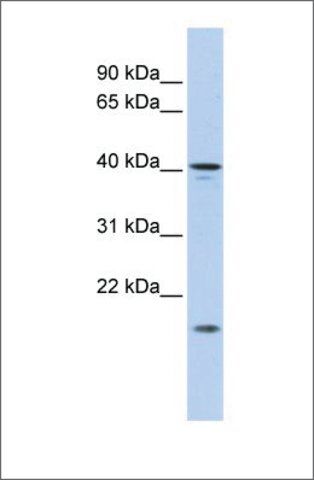 Anti-SLAIN1 antibody produced in rabbit