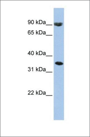 Anti-SLC10A7 antibody produced in rabbit