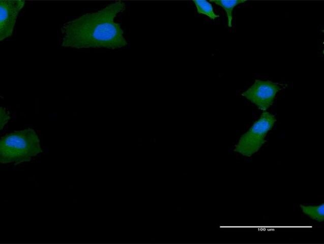 Anti-SKIV2L antibody produced in mouse