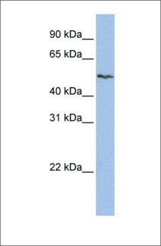 Anti-SLC16A6 antibody produced in rabbit