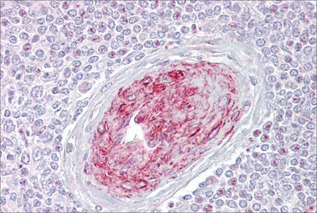 Anti-SLA antibody produced in rabbit