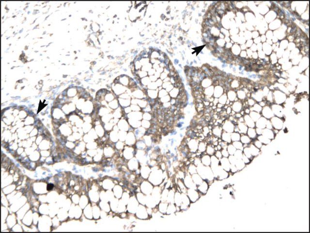 Anti-SLC17A2 antibody produced in rabbit