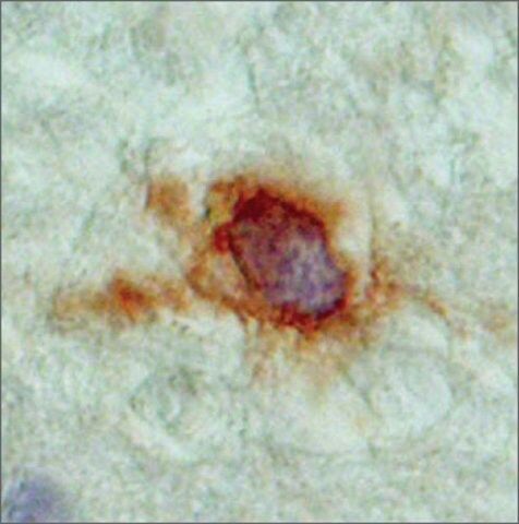 Anti-SLC18A2 antibody produced in rabbit