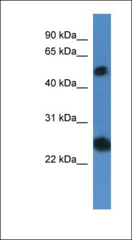 Anti-SLA2 antibody produced in rabbit