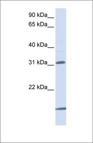 Anti-SLC25A11 (ab2) antibody produced in rabbit