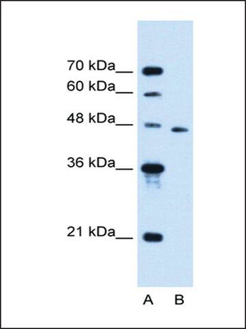 Anti-SLC16A12 antibody produced in rabbit