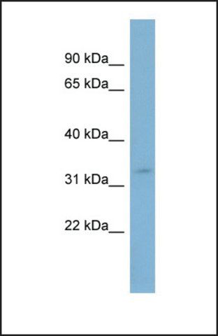 Anti-SLC25A20 antibody produced in rabbit