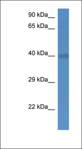 Anti-SLC25A27 antibody produced in rabbit