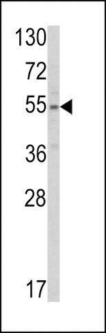 ANTI-SLC38A3 (CENTER) antibody produced in rabbit