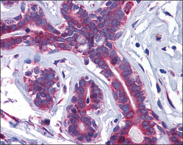 Anti-SLC39A7 antibody produced in rabbit