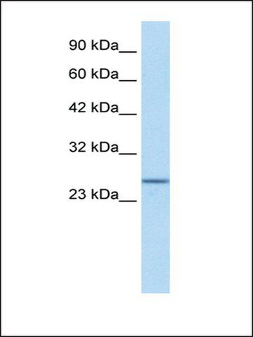 Anti-SOX14 (AB1) antibody produced in rabbit