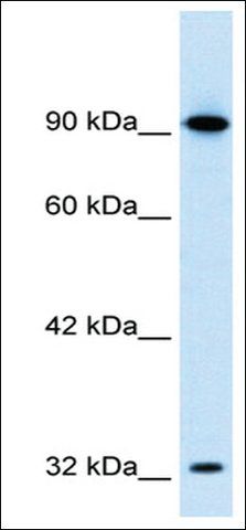 Anti-SOX30 antibody produced in rabbit