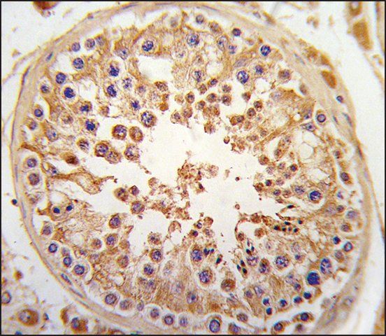 Anti-SPAG9 (N-term) antibody produced in rabbit