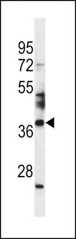 ANTI-SPATA4 (CENTER) antibody produced in rabbit