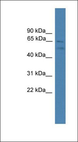 Anti-SPATA2 antibody produced in rabbit