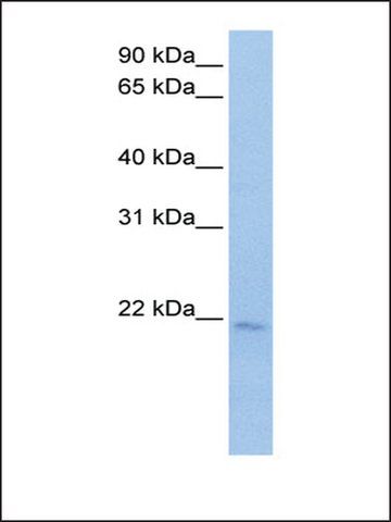 Anti-SPATA12 antibody produced in rabbit