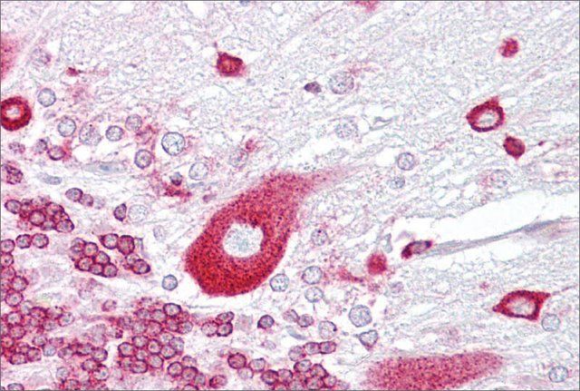Anti-PURA (ab1) antibody produced in rabbit