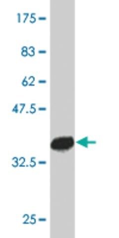 ANTI-PTF1A antibody produced in mouse