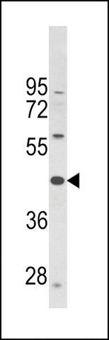 ANTI-PTAR1 (CENTER) antibody produced in rabbit