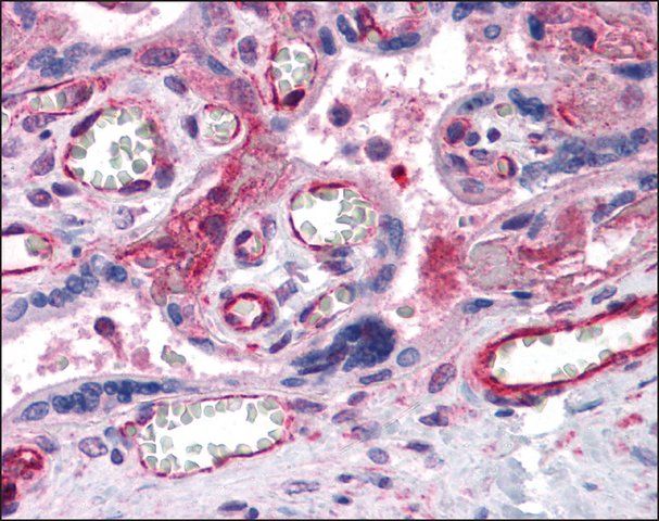 Anti-PTCHD2 antibody produced in rabbit