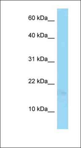 Anti-PSORS1C1 antibody produced in rabbit