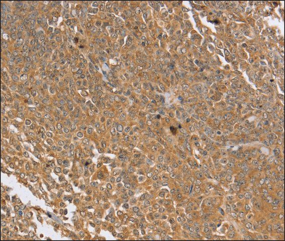 Anti-PTPN20B antibody produced in rabbit