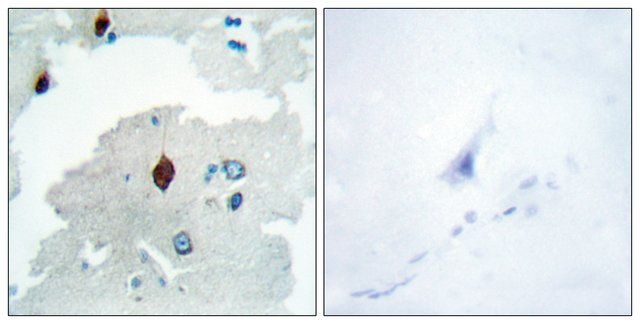 Anti-PTTG antibody produced in rabbit