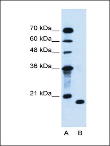 Anti-PTRH2 antibody produced in rabbit