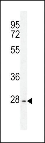 ANTI-PTPN20A (CENTER) antibody produced in rabbit