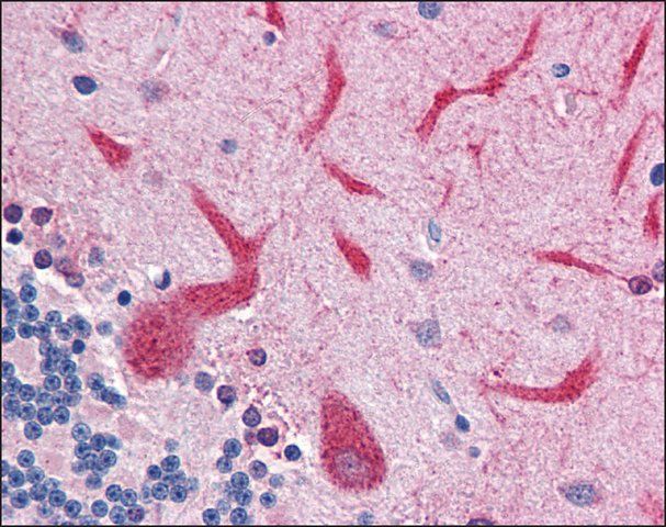 Anti-QSOX2 antibody produced in rabbit