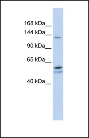 Anti-PUM2, (N-terminal) antibody produced in rabbit