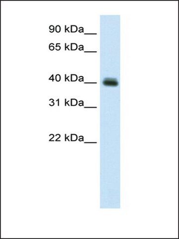 Anti-PUS1 antibody produced in rabbit