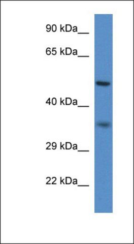 Anti-PXMP3 antibody produced in rabbit