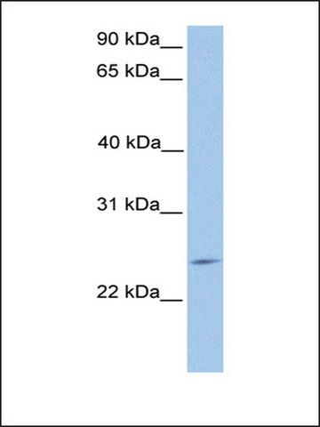 Anti-PTTG2 antibody produced in rabbit
