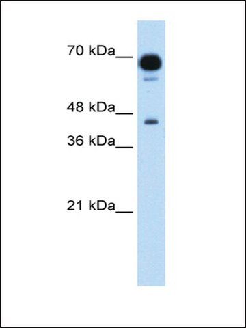 Anti-PUS7 antibody produced in rabbit