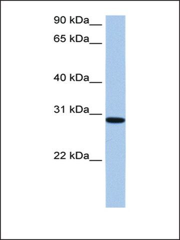 Anti-RALYL antibody produced in rabbit