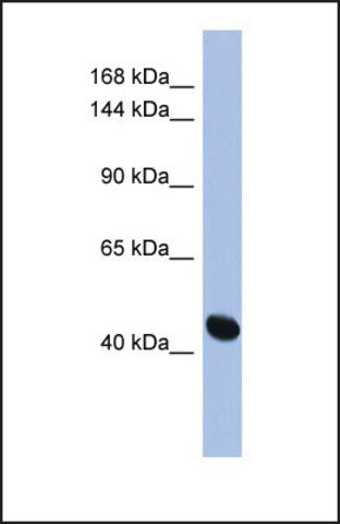 Anti-RASGRF1, (N-terminal) antibody produced in rabbit