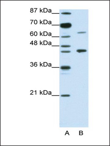 Anti-RARA antibody produced in rabbit