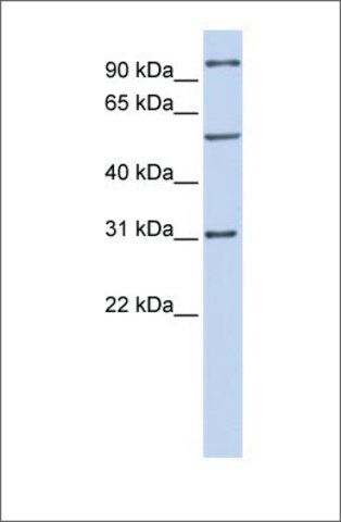 Anti-RAI14 antibody produced in rabbit