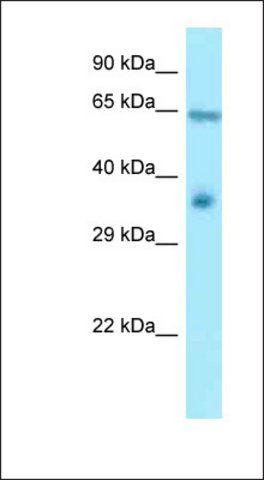Anti-RanGAP1 antibody produced in rabbit