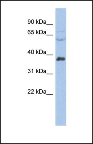 Anti-RALY antibody produced in rabbit