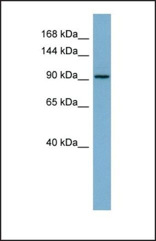 Anti-RAI14 antibody produced in rabbit