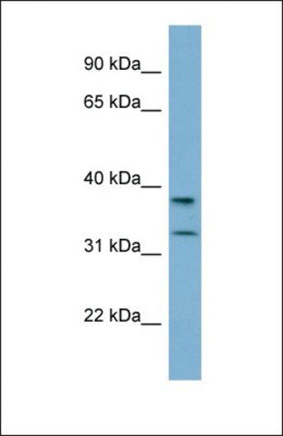 Anti-RALGPS2, (N-terminal) antibody produced in rabbit
