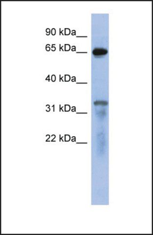 Anti-RAP1GAP antibody produced in rabbit